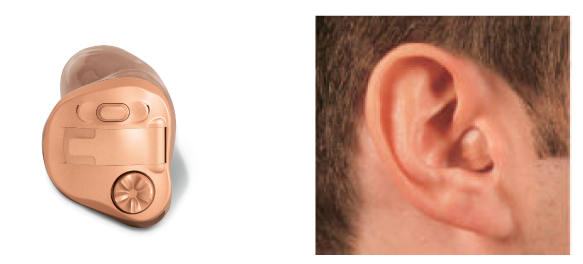 In-the-canal hearing aid example
