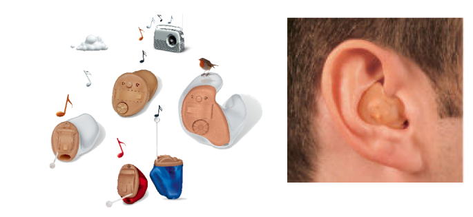 In-the-ear hearing aid example