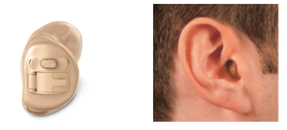 Completely-in-the-canal hearing aid example