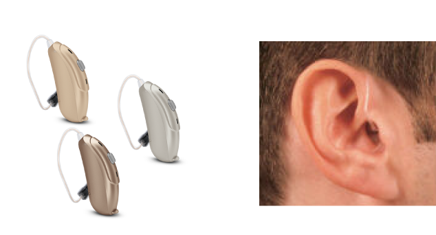 Open fit hearing aid example