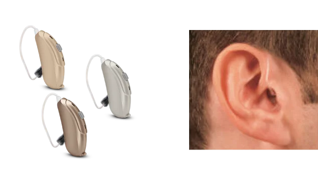 Open fit hearing aid example